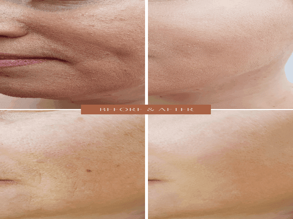 ORGANIC HYALURONIC WRINKLE DEFIER - For Women and Men-1
