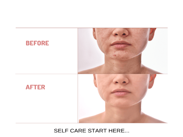 Organic Under Eye Youth Corrector and Neck Renewal Cream Duo - For Women-3